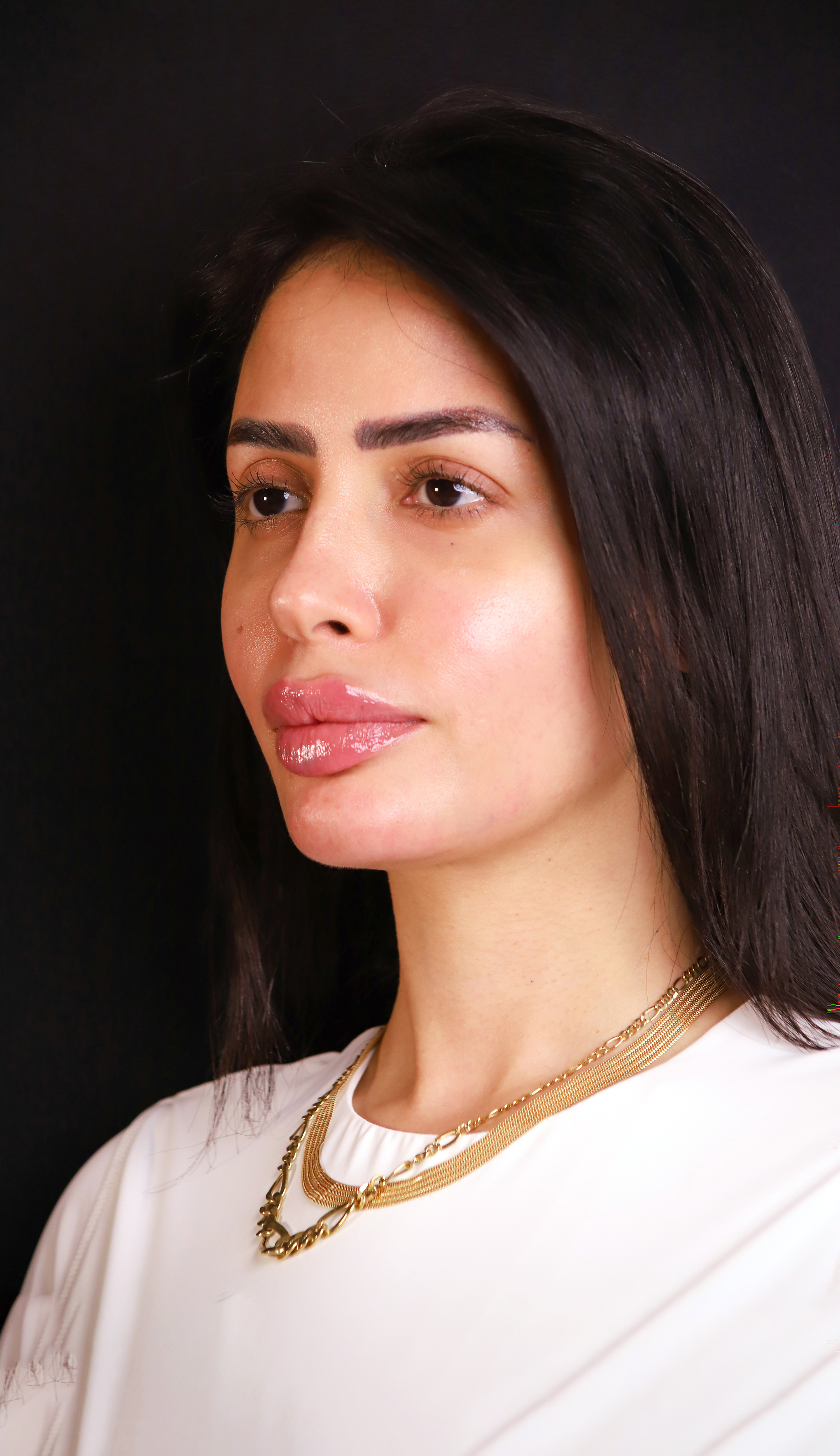 Treatment by Dr. Batoul Reffai