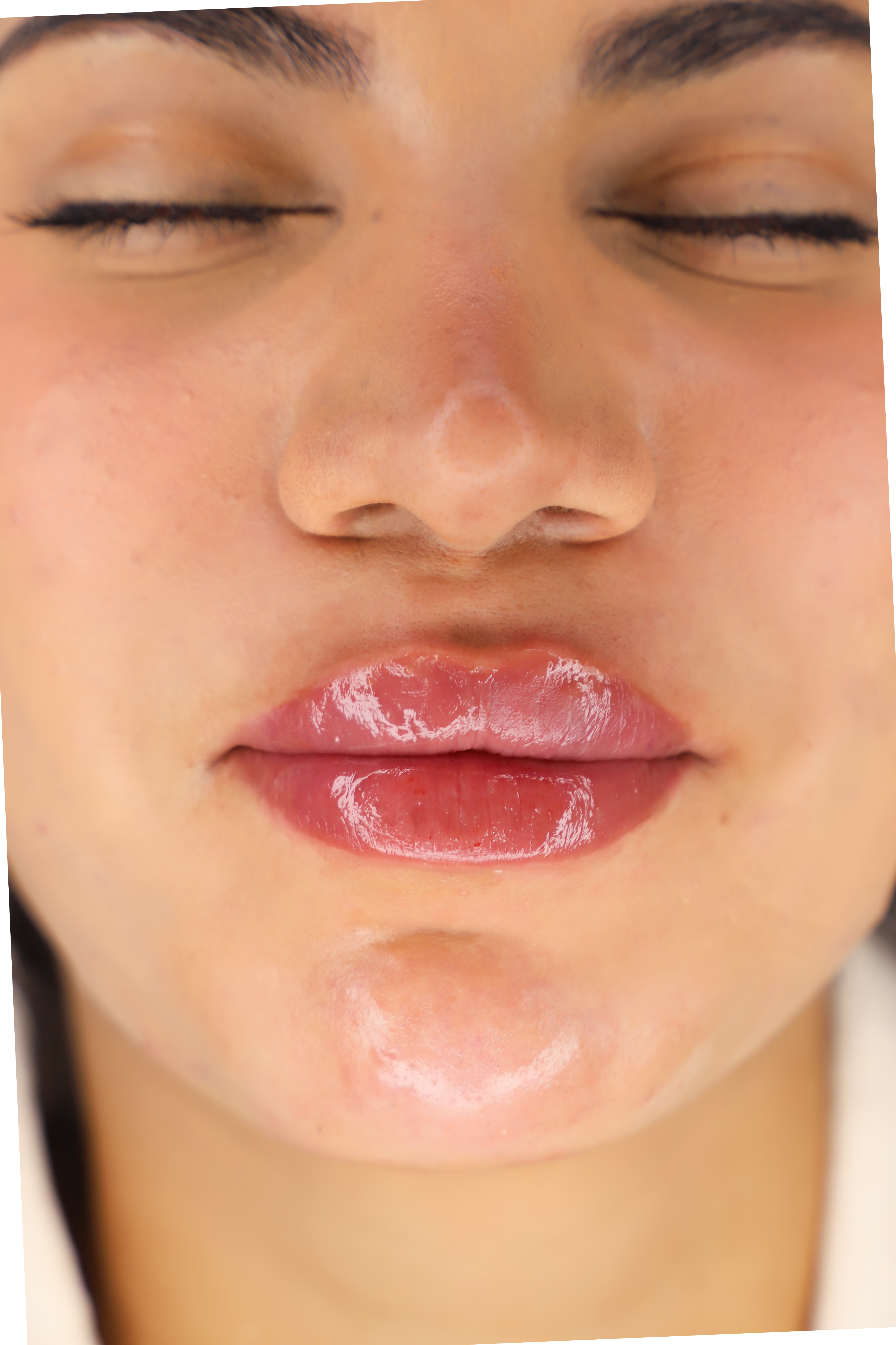 Treatment by Dr. Hadi Salahia